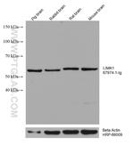 LIMK1 Antibody in Western Blot (WB)
