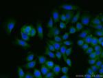 ARHGEF16 Antibody in Immunocytochemistry (ICC/IF)