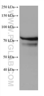 ARHGEF16 Antibody in Western Blot (WB)