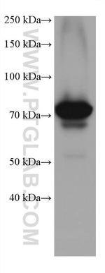 ARHGEF16 Antibody in Western Blot (WB)