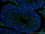 TEX14 Antibody in Immunohistochemistry (Paraffin) (IHC (P))