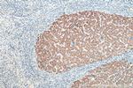 NMT1 Antibody in Immunohistochemistry (Paraffin) (IHC (P))