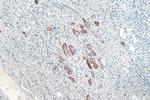NMT1 Antibody in Immunohistochemistry (Paraffin) (IHC (P))