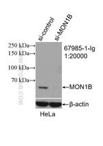 MON1B Antibody in Western Blot (WB)