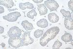 IFT81 Antibody in Immunohistochemistry (Paraffin) (IHC (P))
