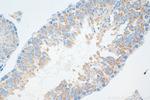 IFT81 Antibody in Immunohistochemistry (Paraffin) (IHC (P))