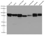 IFT81 Antibody in Western Blot (WB)