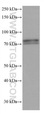 IFT81 Antibody in Western Blot (WB)