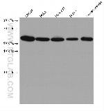 RAD23B Antibody in Western Blot (WB)