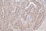 MCM6 Antibody in Immunohistochemistry (Paraffin) (IHC (P))
