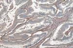 Talin-1 Antibody in Immunohistochemistry (Paraffin) (IHC (P))