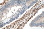 Talin-1 Antibody in Immunohistochemistry (Paraffin) (IHC (P))
