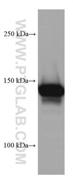 MYBBP1A Antibody in Western Blot (WB)