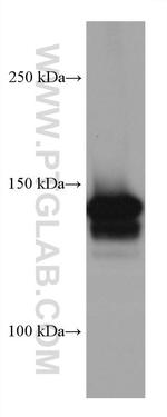 MYBBP1A Antibody in Western Blot (WB)