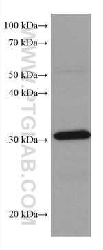 RPA2 Antibody in Western Blot (WB)