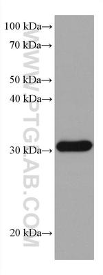 RPA2 Antibody in Western Blot (WB)