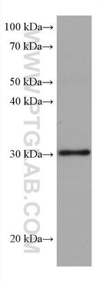 RPA2 Antibody in Western Blot (WB)