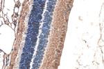 Alpha B Crystallin Antibody in Immunohistochemistry (Paraffin) (IHC (P))