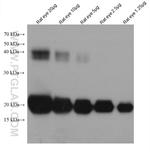 Alpha B Crystallin Antibody in Western Blot (WB)