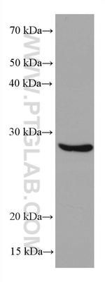 BCAS2 Antibody in Western Blot (WB)