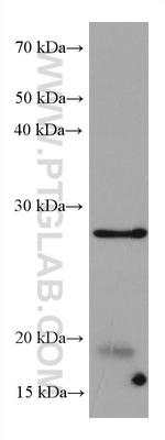 BCAS2 Antibody in Western Blot (WB)