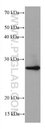 BCAS2 Antibody in Western Blot (WB)