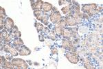 ASNS Antibody in Immunohistochemistry (Paraffin) (IHC (P))