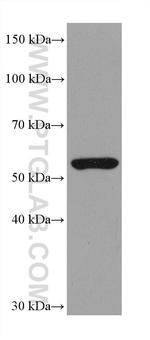 ASNS Antibody in Western Blot (WB)