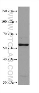 ASNS Antibody in Western Blot (WB)