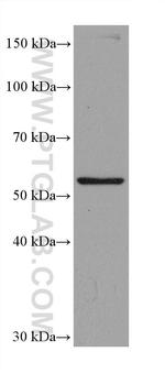 ASNS Antibody in Western Blot (WB)