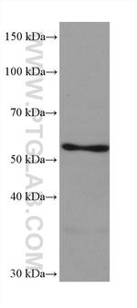 ASNS Antibody in Western Blot (WB)