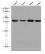 ACAT2 Antibody in Western Blot (WB)