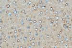 DNM1 Antibody in Immunohistochemistry (Paraffin) (IHC (P))