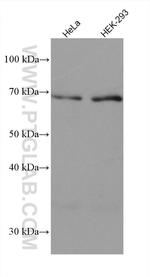 GMEB2 Antibody in Western Blot (WB)