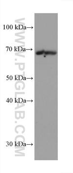 GMEB2 Antibody in Western Blot (WB)