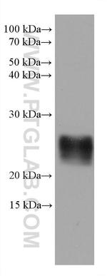 RAB39B Antibody in Western Blot (WB)