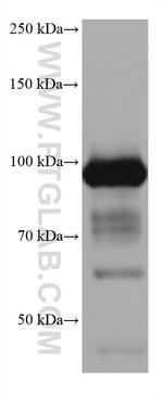 ALDH1L1 Antibody in Western Blot (WB)
