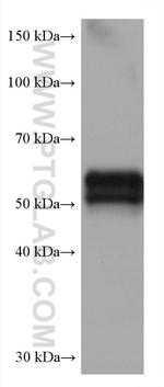 AGT Antibody in Western Blot (WB)