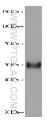 AGT Antibody in Western Blot (WB)