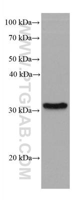 SLC39A3 Antibody in Western Blot (WB)
