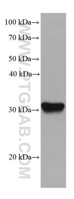 SLC39A3 Antibody in Western Blot (WB)