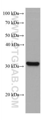 SLC39A3 Antibody in Western Blot (WB)