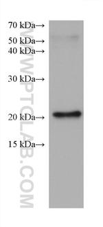 DUSP22 Antibody in Western Blot (WB)
