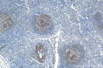 CR1 Antibody in Immunohistochemistry (Paraffin) (IHC (P))