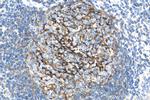 CR1 Antibody in Immunohistochemistry (Paraffin) (IHC (P))
