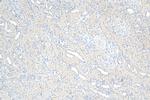 ALDH3A1 Antibody in Immunohistochemistry (Paraffin) (IHC (P))