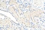 ALDH3A1 Antibody in Immunohistochemistry (Paraffin) (IHC (P))