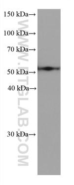 ALDH3A1 Antibody in Western Blot (WB)