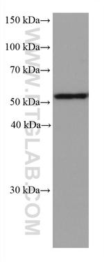 ALDH3A1 Antibody in Western Blot (WB)