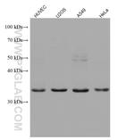 ZFP36L1 Antibody in Western Blot (WB)